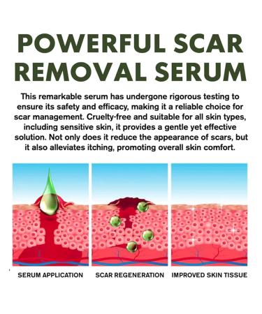 Scar Removal & Skin Repair Serum | Advanced Complex for C-Section, Surgery, Burn, Keloid & Acne | 2 Bottles - Buy Online on GoSupps.com