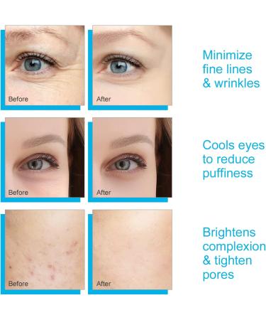 Cryo Ice Roller for Face & Eyes with Cooling Globes - Facial Massager for Puffiness & Migraine Relief - Skin Care Tool for Women and Men - Blue - Buy Online on GoSupps.com