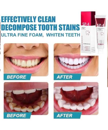 SP-6 & SP-7 Ultra Whitening Toothpaste Set - Probiotic Formula for Stain Removal & Tartar Prevention | International Shipping - Buy Online on GoSupps.com