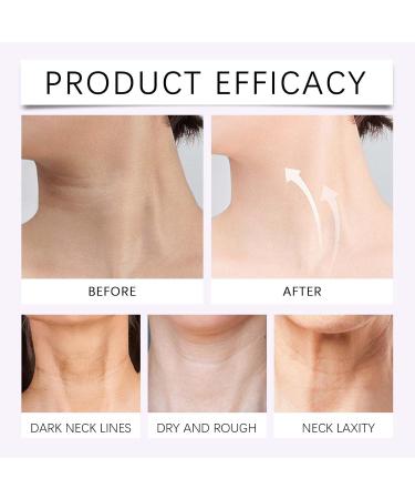 Cr me Pour Le Cou + Patchs Raffermissants Soin Anti- ge Pour Le Cou Hydratation Intense Et Effet Lissant Masque Raffermissant Et Liftant Am lioration De L' lasticit Et De La Fermet De La Peau - Buy Online on GoSupps.com