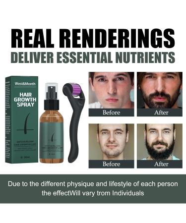 Buy Bart Spray Set - Moisturizing Beard Care | Promotes Thick Growth | 30ml with Roller - Buy Online on GoSupps.com