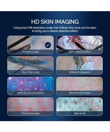 15 Inch Scalp Hair Follicle Moisture Tester | 3 Light & Freeze Frame | Four-Picture Comparison - Best Hair Health Device - Buy Online on GoSupps.com
