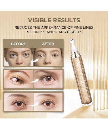 RONKIE Eye Cream for Dark Circles - Pink - 0.5 Fl Oz. - Buy Online on GoSupps.com