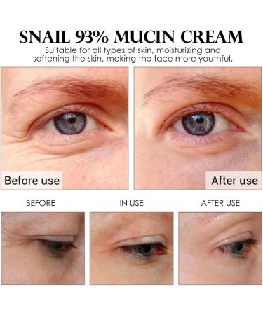 Snail Mucin Moisturiser Snail Cream Snail Mucin Cream with Hydrolyzed Collagen and Snail Filtrate Extract Anti Aging Face Cream for Hydrating Anti Wrinkles - Smooth Fine Lines - Anti Aging - Buy Online on GoSupps.com