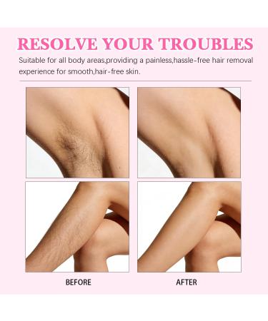 Cyperus Rotundus Hair Removal Oil - Natural Hair Growth Inhibitor | Skin Moisturizing Oil for All Skin Types | 60ml Hair Removal Treatment 1 - Buy Online on GoSupps.com