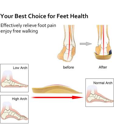 Arch Support Insoles for Plantar Fasciitis | RooRuns 3/4 Orthotic Inserts - Cushion for Flat Feet & Heel Pain Relief - Buy Online on GoSupps.com