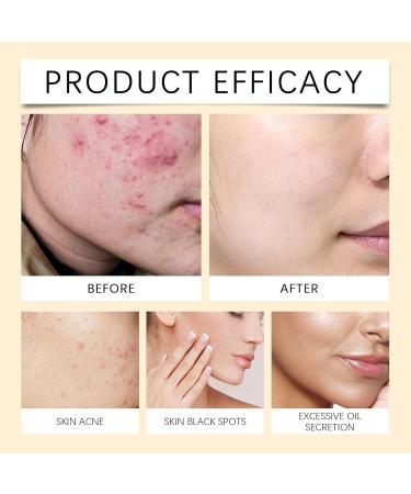 Crsetmyth Facial mask rice and honey rice honey spa mask rice beauty mask ground rice and honey glow mask rice husk powder glow from gemahlenem rice and honey rice ceramide cream for - Buy Online on GoSupps.com