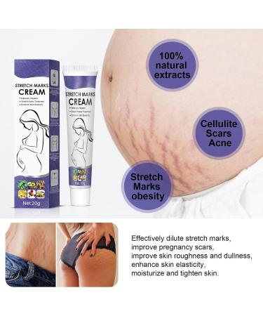 Bploar 2 Pieces Stretch Mark Cream Anti Stretch Mark Cream Stretch Mark Repair Cream Gentle Moisturizing Cream for Stretch Mark Prevention and Treatment 1 - Buy Online on GoSupps.com