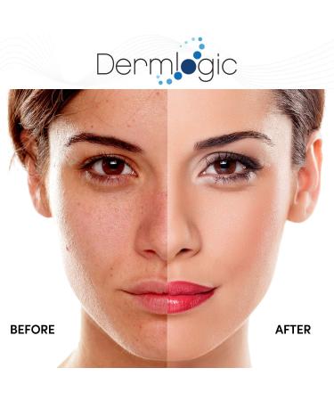 15% Glycolic Cream: Natural Anti-Aging Exfoliator for Smooth, Youthful Skin - A.H.A & Green Tea Moisturizer for Face & Body - Buy Online on GoSupps.com