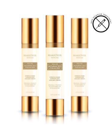 Healing Advanced Aftercare Cream - Organic Stretch Marks & Scar Treatment - Vitamin A E Castor Oil & Cocoa Butter - 50ml Belly Butter for Improved Circulation - Non-Invasive Care - Buy Online on GoSupps.com