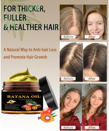 100% Raw Batana Oil for Hair Growth Organic Dr. Sebi Batana Oil from Honduras Unrefined Batana Oil Prevents Hair Loss Pure and Natural Hair Treatment for Curly Hair Enhances Hair Thickness - Buy Online on GoSupps.com