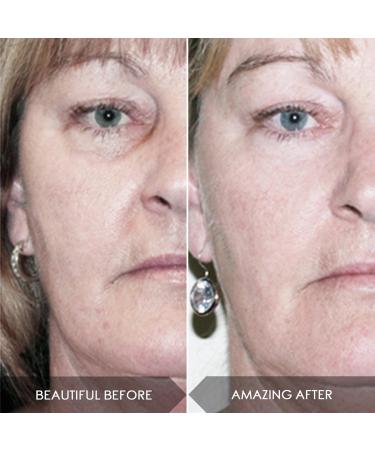 Midnight Magic Cell Serum Mini - With 100% Actives Mini + Niacinamide - Acne- Dark Spots-Rough Skin Gentle Exfoliator - Buy Online on GoSupps.com