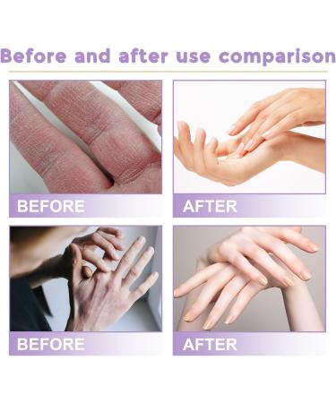 Masque pour Les Mains 6 Paires Gants Hydratants Masques Exfoliants pour Les Mains pour les peaux s ches la main et la peau s che Nourrissante Anti- ge et R parent la Peau Rugueuse - Buy Online on GoSupps.com