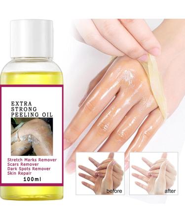  SVCEQZE Yellow Peeling Oil - Ordinary Scrub Solution and Body Oil Exfoliating Oil for Dark Skin Dark Sports Remover Suitable for Hands and Feet - Buy Online on GoSupps.com