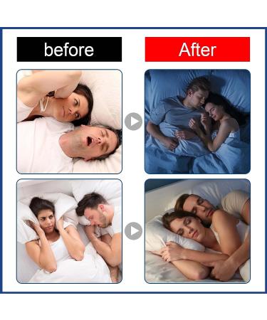 60Pcs Gentle Sleep Mouth Tape for Nasal Breathing | Anti Snoring Strips for Nose Breathing | Improve Sleep Quality & Stop Snoring - Buy Online on GoSupps.com