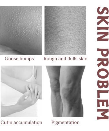 Body Scrub Exfoliator - Face Scrub - Coffee Moisturizing Exfoliating Body Scrub - Cleansing Skin - Lightening Dark Spots - Firming Skin - Even Skin Tone - Easy to Absorb - Formula Friendly - Buy Online on GoSupps.com