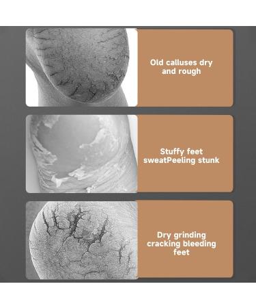 Fhkpsqkcn Moisturizing Heel Socks - Cracked Gel Socks - Heel Repair Socks for Men and Women - Gel Socks for Dry Cracked Feet - Buy Online on GoSupps.com