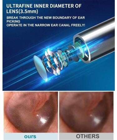 XKOO Ear Wax Removal Kit - 1080P FHD Otoscope & 6 LED Lights - Wireless Ear Camera - 8pcs Accessories - Multifunctional Black - Buy Online on GoSupps.com