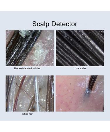 Portable Scalp Detector Intelligent Handheld Hair Follicle Analyzer for Skin Diagnosis - Buy Online on GoSupps.com
