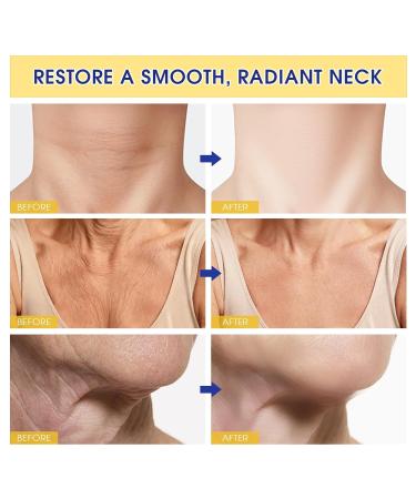 NAILKISS Neck Cream Anti-Aging Neck Firming Roller Cream for Hydrating & Tightening with Collagen Vitamin C Hyaluronic Acid Lifts & Smooths Skin Care Repair for Women - Buy Online on GoSupps.com