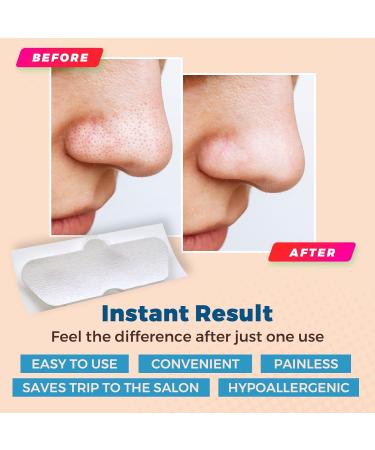 Nose Pore - Blackhead Removing and Pore Unclogging Deep Cleansing Pore Strip Combo Pack 96 Count Strips - Buy Online on GoSupps.com
