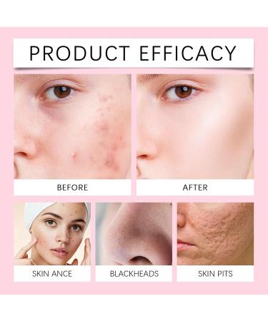 Deep Moisturizing Facial Cleanser - Gentle Cleanse Hydrating Non-Tightening Soothes Skin Removes Dirt & Oil(2PCS) - Buy Online on GoSupps.com