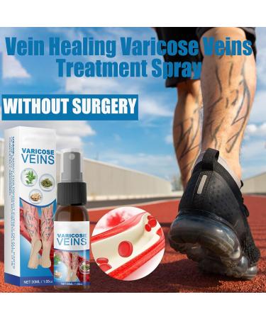 Xirujnfd Vein Healing Spray - Effective Varicose Veins Treatment for Legs | Improve Blood Circulation (1PCS) - Buy Online on GoSupps.com