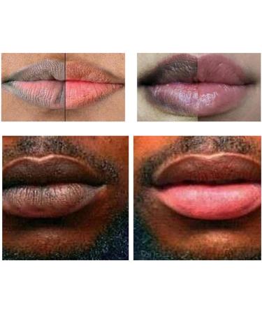 Pink Lip Lightening Treatment Lips Fast Whitening Treatment Dark Lightening Lips Fresh Pink Cream Removes Lip Butters Lip Makeup - Buy Online on GoSupps.com