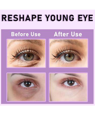  G n rique Iouyjiu Eye Bag Cream 0.68oz Hydrating Eye Lotion Nourishing Lifting Moisturizer Gentle Skin Tightener Formula for Adults Women Men Travel Home - Buy Online on GoSupps.com