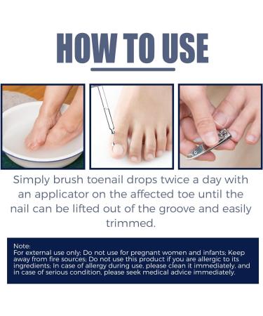 Ingrown Toenail Treatment Correction Drops Nail Growth Treatment Nail Care Ingrowing Toenail Treatment Ingrown Toenail Corrector Treatment for Ingrown Toenail Ingrowing Toenail Improve Toenail Health - Buy Online on GoSupps.com