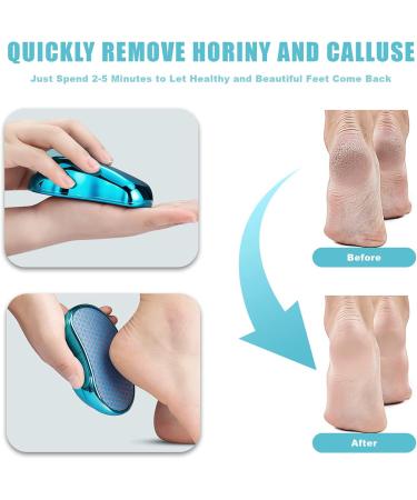 Puikos Nano Glass Corneal Remover | 2-in-1 Wet & Dry Cornea Plane for Safe Home Foot Care | Effective Corneal File for Hands & Feet (Blue) - Buy Online on GoSupps.com