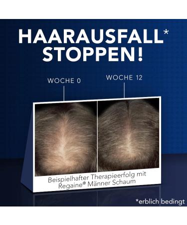 Regaine Men Foam - 3-Month Pack | 50 mg/g Minoxidil for Hair Loss & Growth | Ships Internationally - Buy Online on GoSupps.com