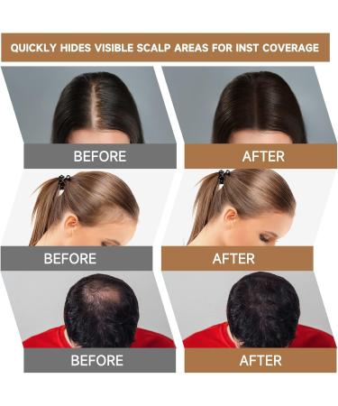  Mifeloy MIFELOY Invisible Hair Root Powder for Men Women Immediate Effect for Thickening Hair Hide Thin Areas Bald Grey White - Buy Online on GoSupps.com