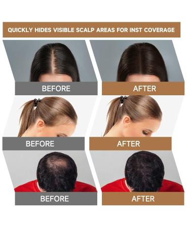 Buy Mifeloy Hairline Powder Set - Light Brown Invisible Concealer with Mirror & Sponge | Waterproof Hair Makeup for Instant Coverage - Perfect for Men & Women - Buy Online on GoSupps.com