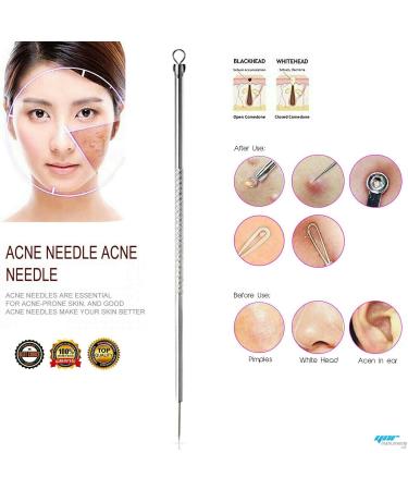 YNR Needle Acne Blackhead Remover Pimple Extractor Tool Pimple Spot Removal Tool Used to Remove Facial Blackheads and Pimples - Buy Online on GoSupps.com