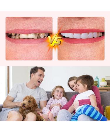 Natural Shade Fake Teeth Veneers Set for Upper and Lower Jaw 6pcs Cosmetic Dentures for Christmas and Daily Use - Buy Online on GoSupps.com