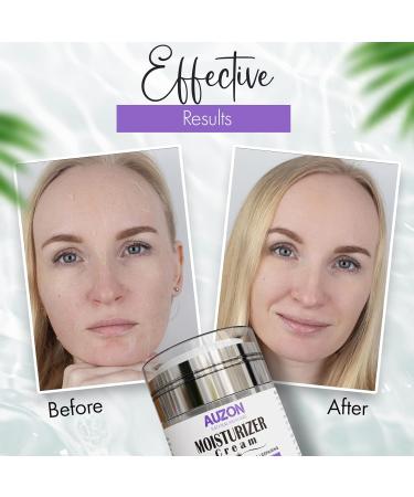 Moisturizing Face Cream with Hyaluronic Acid | Natural Hydrating Facial Moisturizer for All Skin Types | Intensive Hydration with Plant Extracts - Buy Online on GoSupps.com