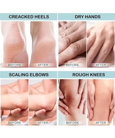 DMQ 42% Urea Foot Cream Moisturizing Cracked Heel Repair Cream for Feet and Hand Hard Skin Remover Foot Cream Deep Moisturizing Callus Remover Nourishes Soften for Body Feet Knees and Hand - Buy Online on GoSupps.com