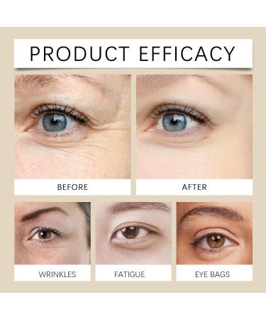 Serum Creme Yeux La Caf ine Cr me Contour Des Yeux De 20 Ml contour des yeuxCr me Anti Cernes Et Poches Serum Yeux Boule De Massage 360 limine Efficacement Les Rides unisexe (4PC) - Buy Online on GoSupps.com