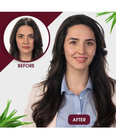 Maxxam Hair & Scalp Mender Leave-in Spray - Moisturizes & Rejuvenates Dry Scalp & Damaged Hair | Alcohol Free | 8 Fl Oz - International Shipping Available - Buy Online on GoSupps.com