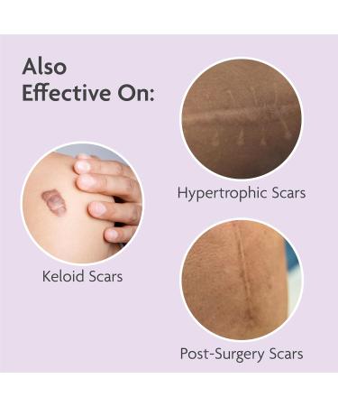 TriLASTIN Silicone Scar Sheets (6 Count) - Medical Grade Silicone Scar Tape for Keloid and Bump Removal - Buy Online on GoSupps.com