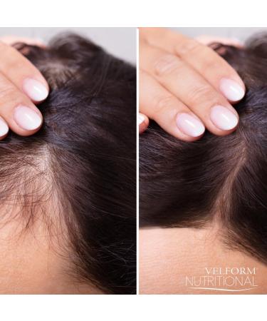 Velform Nutritional 200 ml Nourishing Vitalizing Hair Lotion - Buy Online on GoSupps.com