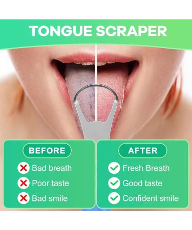 Metal Tongue Scraper for Adults & Kids | Stainless Steel Tongue Cleaner with Case | Reduce Bad Breath & Breathe Fresh - Light Blue - Buy Online on GoSupps.com