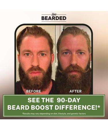Live Bearded Beard Boost - Hair Growth Multivitamins with Biotin 10 000mcg Vitamin C & E - 60-Day Supply for Strong Full Beards - Made in USA - Buy Online on GoSupps.com