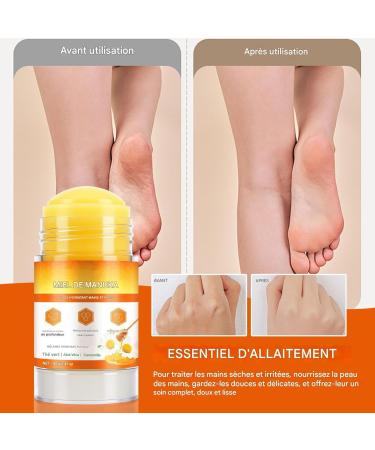  WJnflQN Stick Heel Cracks | Heel Balm - 40g Moisturizing Stick Intense Hydration Cream for Face Hands and Feet with Peeling Effect in Use for Pedicure and Travel - Buy Online on GoSupps.com