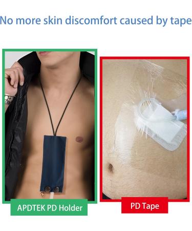 Peritoneal Dialysis Catheter Holder for Baxter 5C4482 & 5C4483 | Secure PD Lanyard & Shower Support Accessories for Men & Women - Buy Online on GoSupps.com