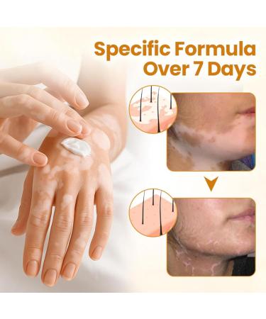 Foot Cream - Care Lotion | Nourishing and Illuminating Plant Extracts to Moisturize Dry Sensitive Skin on the Body and Hands - Buy Online on GoSupps.com