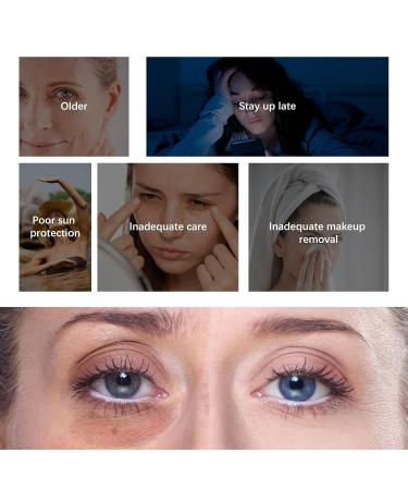 Retinol Eye Cream with Hyaluronic Acid & Collagen | Anti-Aging Solution for Dark Circles Puffiness & Fine Lines - Buy Online on GoSupps.com