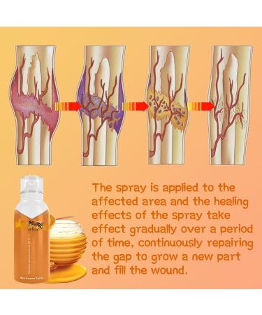 Body Therapy Bee Venom Joint & Bone Spray Intensive Concentrate - Fast Muscle Recovery | 2023 New Bee Venom Serum (1PC) - Buy Online on GoSupps.com