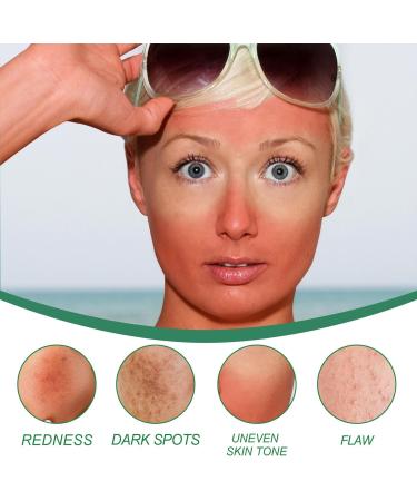 Color Correcting Cream Hydrating Color Correcting Treatment Cream Redness Correcting Cream After-Sun Care Pigment Correcting Cream Lighten Spots Soothing Facial Cream - 3.52Fl.oz - Buy Online on GoSupps.com